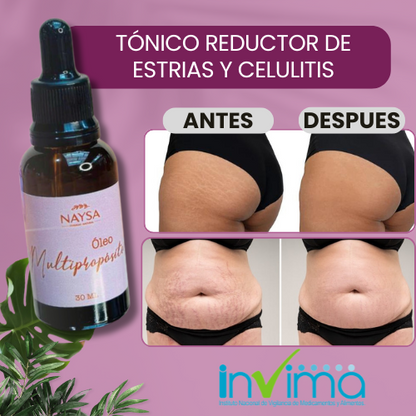 TÓNICO REDUCTOR DE ESTRIAS Y CELULITIS